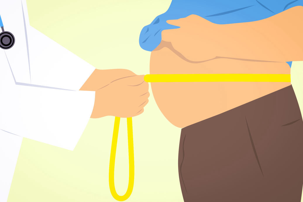 Psicologia Bariatrica e tecnicas cirurgicas disponiveis para o tratamento da obesidade - TCC - NeuroFlux