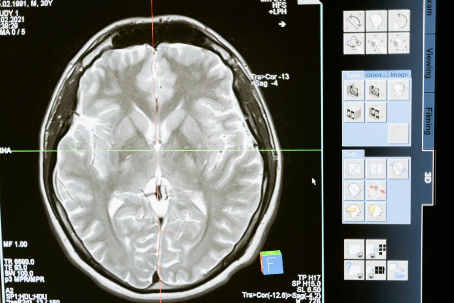 Neurodesenvolvimento e saude mental - TCC - NeuroFlux